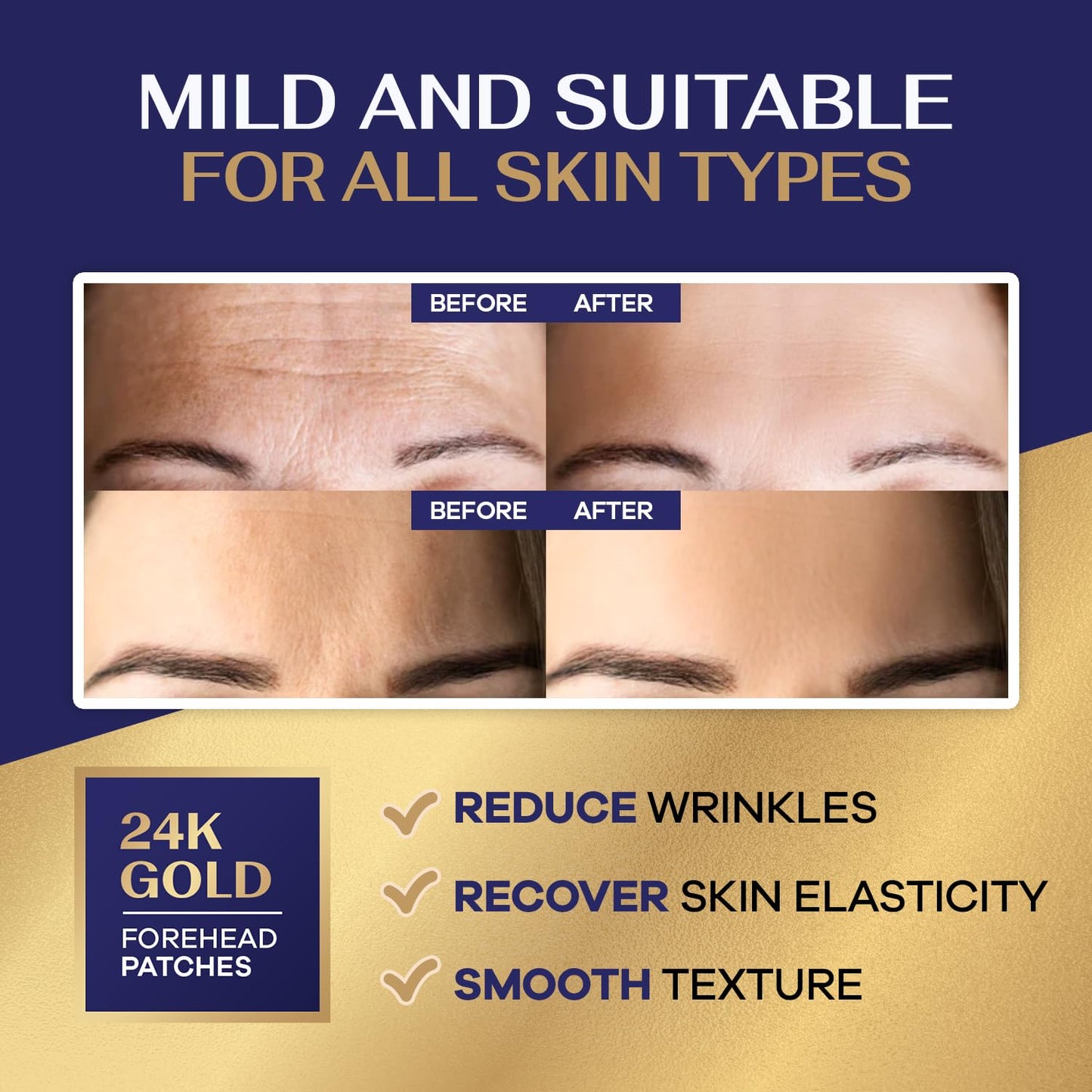 Collagen Forehead Wrinkle Patches: Facial patches with 12 Packs, Forehead Patches for Wrinkles Anti Wrinkle Patches Treatmen.